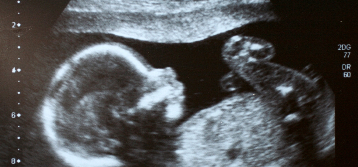 Co zwiastuje poród?